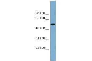 WB Suggested Anti-SLC2A8 Antibody Titration:  0. (SLC2A8 抗体  (Middle Region))