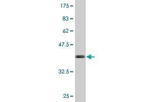 Western Blot detection against Immunogen (41. (BST2 抗体  (AA 40-180))