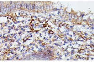 Immunohistochemistry of paraffin-embedded Human appendix using SNAP23 Polyclonal Antibody at dilution of 1:100 (40x lens). (SNAP23 抗体)
