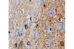 IHC-P analysis of Brain tissue, with DAB staining. (GDF10 抗体  (AA 337-477))