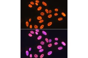 Immunofluorescence analysis of U-2 OS cells using hnRNP K Rabbit mAb (ABIN7267634) at dilution of 1:100 (40x lens). (HNRNPK 抗体)