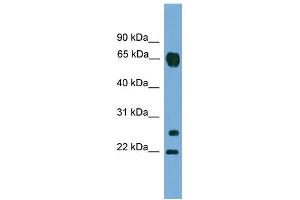 WB Suggested Anti-MMP26 Antibody Titration: 0. (MMP26 抗体  (C-Term))