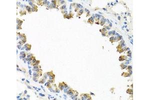 Immunohistochemistry of paraffin-embedded Mouse lung using TICAM1 Polyclonal Antibody at dilution of 1:100 (40x lens). (TICAM1 抗体)