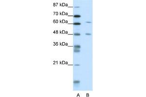 WB Suggested Anti-NAB2 Antibody Titration:  1. (NAB2 抗体  (N-Term))