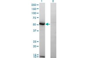 Western Blot analysis of ASAH1 expression in transfected 293T cell line by ASAH1 monoclonal antibody (M02), clone 1A7. (ASAH1 抗体  (AA 25-124))