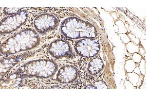 Detection of IFNb in Human Colon Tissue using Monoclonal Antibody to Interferon Beta (IFNb) (IFNB1 抗体)