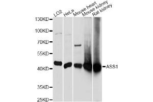 Western blot analysis of extracts of various cell lines, using ASS1 antibody. (ASS1 抗体)