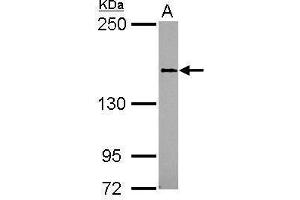 WB Image Sample (30 ug of whole cell lysate) A: 293T 5% SDS PAGE antibody diluted at 1:1000 (SEMA4D/CD100 抗体)