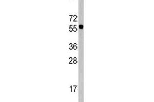 Western blot analysis of CDC6 antibody in Ramos lysate. (CDC6 抗体  (AA 32-61))