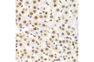 Immunohistochemistry (Paraffin-embedded Sections) (IHC (p)) image for anti-Histone 3 (H3) (H3K9me3) antibody (ABIN3016030)