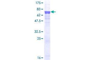 AGT Protein (AA 1-485) (GST tag)