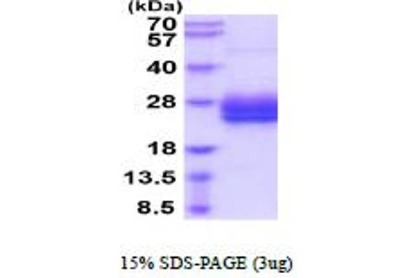 IL29 Protein (AA 20-200) (His tag)