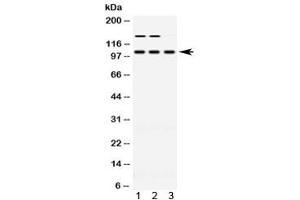 Western blot testing of 1) rat skeletal muscle, 2) mouse skeletal muscle and 3) human HT080 lysate with ACTN3 antibody at 0. (ACTN3 抗体  (AA 574-617))