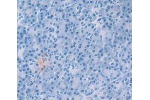 IHC-P analysis of Human Tissue, with DAB staining. (GDF15 抗体  (AA 195-308))