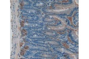 Immunohistochemistry (IHC) image for anti-Arginase, Type II (ARG2) (AA 23-354) antibody (ABIN1077838)