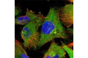 Immunofluorescent staining of human cell line U-251 MG shows positivity in plasma membrane, cytoplasm & golgi apparatus. (ZC3HAV1 抗体)