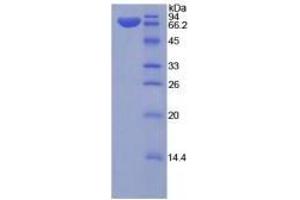 SDS-PAGE analysis of Rat Klotho Protein. (Klotho Protein (KL))