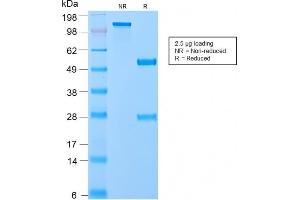 SDS-PAGE Analysis of Purified VLDL-Receptor Rabbit Recombinant Monoclonal Antibody (VLDLR/2896R). (Recombinant VLDLR 抗体  (C-Term))