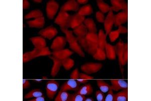 Immunofluorescence analysis of U2OS cells using EIF5A Polyclonal Antibody (EIF5A 抗体)