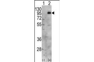 Western blot analysis of PIP5K1C (arrow) using PIP5K1G Antibody (C-term) (ABIN392596 and ABIN2842125). (PIP5K1C 抗体  (C-Term))