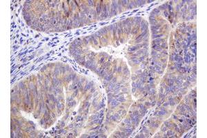 Image no. 7 for anti-Integrin alpha FG-GAP Repeat Containing 3 (ITFG3) antibody (ABIN1498916)