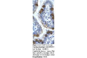 Immunohistochemistry (IHC) image for anti-Cyclin-Dependent Kinase 7 (CDK7) (C-Term) antibody (ABIN2792153) (CDK7 抗体  (C-Term))