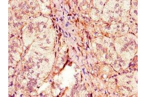 Immunohistochemistry of paraffin-embedded human adrenal gland tissue using ABIN7162949 at dilution of 1:100 (ACOX1 抗体  (AA 113-273))