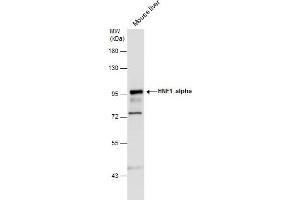 WB Image HNF1 alpha antibody [N1N3] detects HNF1 alpha protein by western blot analysis. (HNF1A 抗体)