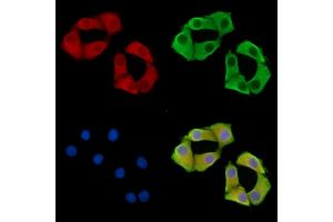 ABIN7095844 and ABIN7099906 staining Hela cells by IF/ICC. (B4GALNT3 抗体)