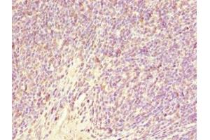 Immunohistochemistry of paraffin-embedded human thymus tissue using ABIN7153505 at dilution of 1:100 (GABRR1 抗体  (AA 365-465))