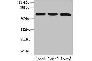 Western blot All lanes: ZNF554 antibody at 5 μg/mL Lane 1: K562 whole cell lysate Lane 2: U937 whole cell lysate Lane 3: A549 whole cell lysate Secondary Goat polyclonal to rabbit IgG at 1/10000 dilution Predicted band size: 61 kDa Observed band size: 61 kDa (ZNF554 抗体  (AA 239-538))