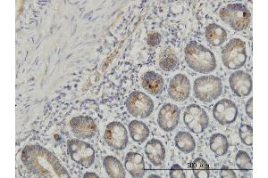 Immunoperoxidase of monoclonal antibody to IL1F7 on formalin-fixed paraffin-embedded human small Intestine. (IL-37 抗体  (AA 1-218))