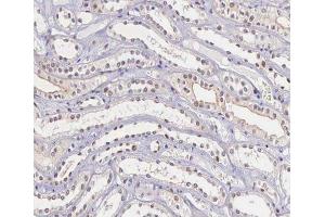 ABIN6266662 at 1/100 staining human kidney tissue sections by IHC-P. (TIMP4 抗体  (C-Term))