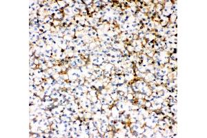 IHC analysis of MCP1/CCL2 using anti-MCP1/CCL2 antibody (ABIN3042598). (CCL2 抗体  (AA 24-99))