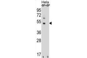 Western Blotting (WB) image for anti-DnaJ (Hsp40) Homolog, Subfamily B, Member 6 (DNAJB6) antibody (ABIN2996781) (DNAJB6 抗体)