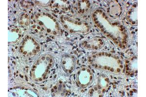 Immunohistochemistry (IHC) image for anti-Polypyrimidine Tract Binding Protein 1 (PTBP1) (N-Term) antibody (ABIN185079)