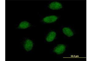Immunofluorescence of purified MaxPab antibody to SNAI1 on HeLa cell. (SNAIL 抗体  (AA 1-264))