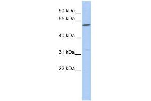 CEACAM16 antibody used at 1 ug/ml to detect target protein. (CEACAM16 抗体  (Middle Region))