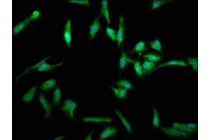 Immunofluorescence staining of Hela cells with ABIN7173813 at 1:330, counter-stained with DAPI. (FASL 抗体  (AA 103-281))