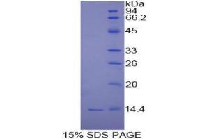 SDS-PAGE (SDS) image for Chemokine (C-X-C Motif) Ligand 11 (CXCL11) (AA 22-94) protein (His tag) (ABIN1080041)