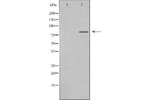 Western blot analysis of extracts from K562 cells, using MLH1 antibody. (MLH1 抗体  (Internal Region))