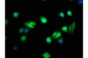 Immunofluorescence staining of HepG2 cells with ABIN7152575 at 1:133, counter-stained with DAPI. (FAIM 抗体  (AA 1-179))