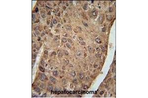 Immunohistochemistry (Paraffin-embedded Sections) (IHC (p)) image for anti-Ribosomal Protein L27a (RPL27A) (AA 110-138), (C-Term) antibody (ABIN654891)