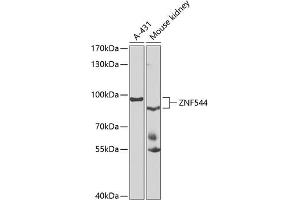 Western blot analysis of extracts of various cell lines, using ZNF544 antibody (ABIN6133073, ABIN6150511, ABIN6150513 and ABIN6223223) at 1:1000 dilution. (ZNF544 抗体  (AA 1-230))