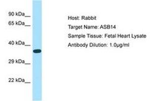 ASB14 antibody  (AA 45-94)
