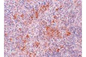 Immunohistochemical staining of mouse kidney tissue with 2. (Angiotensin II Type-1 Receptor 抗体  (Internal Region))