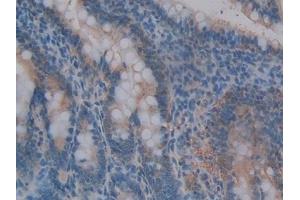 Detection of MMP3 in Rat Intestine Tissue using Polyclonal Antibody to Matrix Metalloproteinase 3 (MMP3) (MMP3 抗体  (AA 98-475))