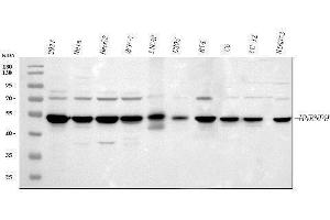 Western blot analysis of HnRNP H/HNRNPH1 using anti-HnRNP H/HNRNPH1 antibody (ABIN4886623). (HNRNPH1 抗体  (N-Term))