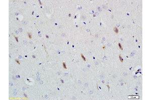 Formalin-fixed and paraffin embedded rat brain tissue labeled with Rabbit Anti-Neuroligin 1 Polyclonal Antibody  at 1:200 followed by conjugation to the secondary antibody and DAB staining.