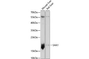 Western blot analysis of extracts of various cell lines, using S antibody (ABIN7270255) at 1:3000 dilution. (SAA1 抗体  (AA 1-100))